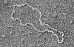 Electron micrograph of plasmid DNA