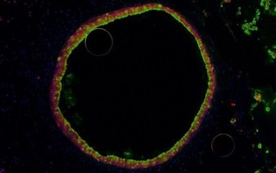 Human intestinal organoid