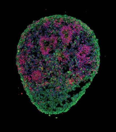 Brain 'organoids' similar to the one shown here, are revealing how the neurons of individuals with autism spectrum disorders differ from those of unaffected family members. Image credit: J. Mariani et al. Cell 162, 375-390 (2015).