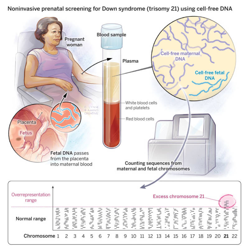 noninvasive-prenatal-testing-using-fetal-dna-lasker-foundation