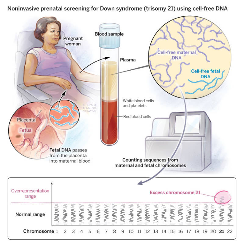 Noninvasive Prenatal Testing Using Fetal DNA - Lasker Foundation